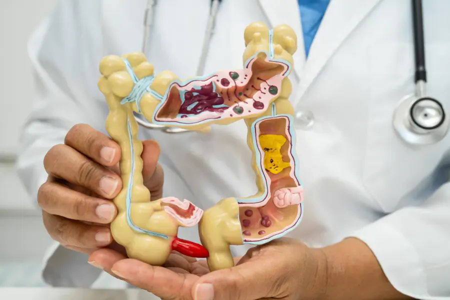 Especialista en padecimientos gastrointestinales explicando el aparato digestivo con un modelo anatómico en Toluca